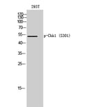 Western Blot - Anti-Chk1 (phospho Ser301) Antibody (A0862) - Antibodies.com