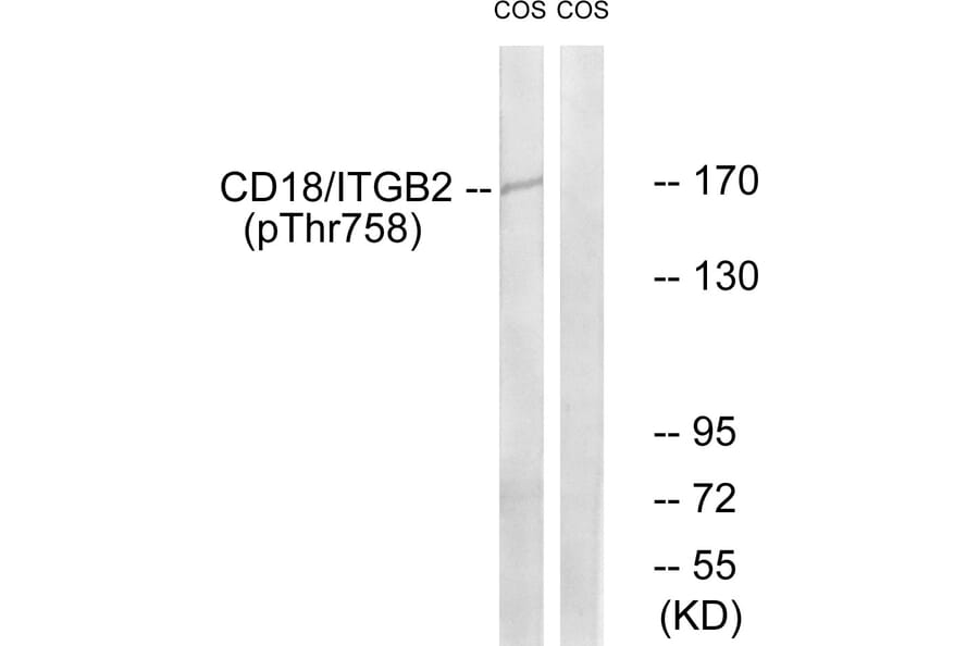 Western Blot - Anti-CD18 (phospho Thr758) Antibody (A0842) - Antibodies.com