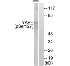 Western Blot - Anti-YAP (phospho Ser127) Antibody (A0757) - Antibodies.com