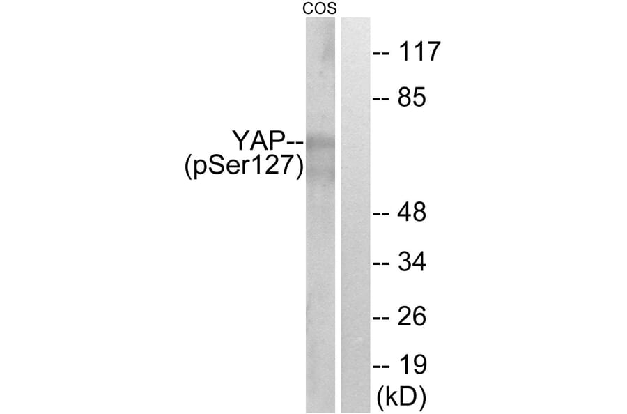 Western Blot - Anti-YAP (phospho Ser127) Antibody (A0757) - Antibodies.com