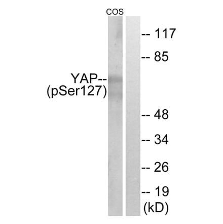 Western Blot - Anti-YAP (phospho Ser127) Antibody (A0757) - Antibodies.com