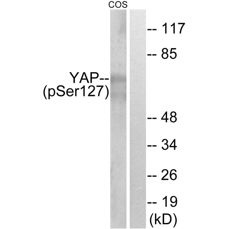 Western Blot - Anti-YAP (phospho Ser127) Antibody (A0757) - Antibodies.com