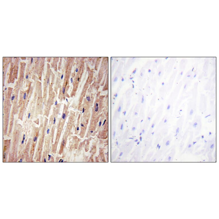 Immunohistochemistry - Anti-YAP (phospho Ser127) Antibody (A0757) - Antibodies.com