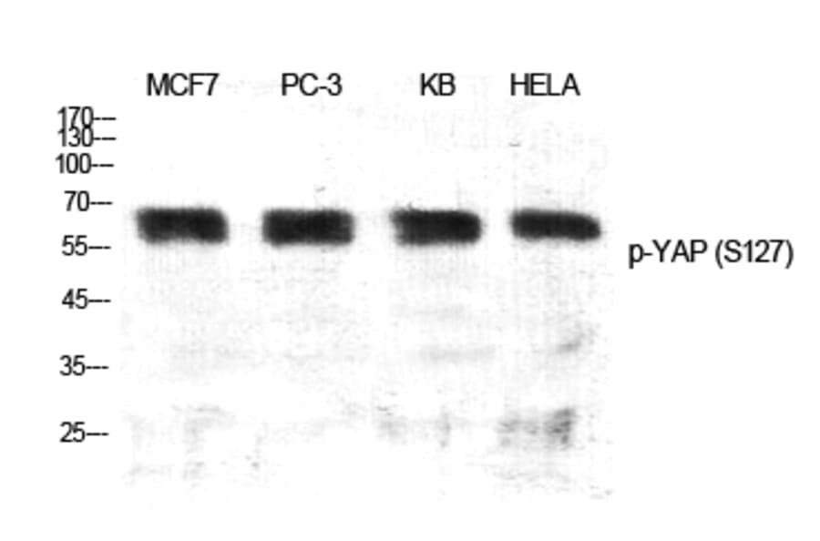 Western Blot - Anti-YAP (phospho Ser127) Antibody (A0757) - Antibodies.com