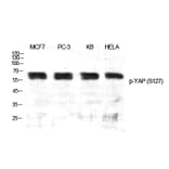 Western Blot - Anti-YAP (phospho Ser127) Antibody (A0757) - Antibodies.com