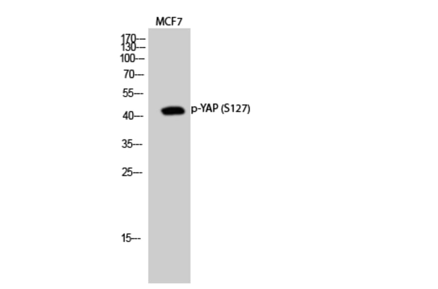 Western Blot - Anti-YAP (phospho Ser127) Antibody (A0757) - Antibodies.com