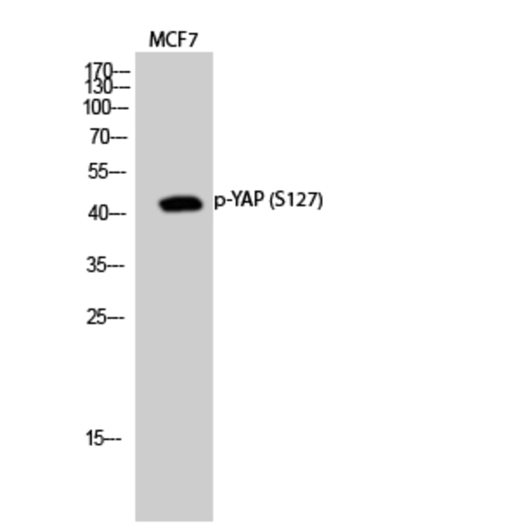 Western Blot - Anti-YAP (phospho Ser127) Antibody (A0757) - Antibodies.com