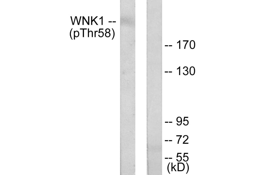 Western Blot - Anti-WNK1 (phospho Thr58) Antibody (A0093) - Antibodies.com