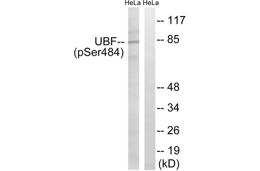 Western Blot - Anti-UBF (phospho Ser484) Antibody (A8444) - Antibodies.com