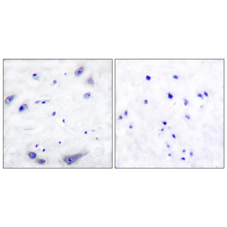 Immunohistochemistry - Anti-Tyrosine Hydroxylase Antibody (B0038) - Antibodies.com