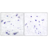 Immunohistochemistry - Anti-Tyrosine Hydroxylase Antibody (B0038) - Antibodies.com