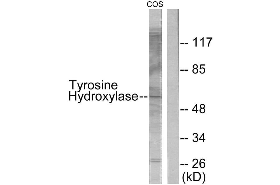 Western Blot - Anti-Tyrosine Hydroxylase Antibody (B0038) - Antibodies.com
