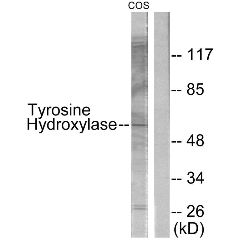 Western Blot - Anti-Tyrosine Hydroxylase Antibody (B0038) - Antibodies.com