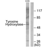 Western Blot - Anti-Tyrosine Hydroxylase Antibody (B0038) - Antibodies.com
