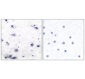 Immunohistochemistry - Anti-Tau (phospho Ser422) Antibody (A7243) - Antibodies.com