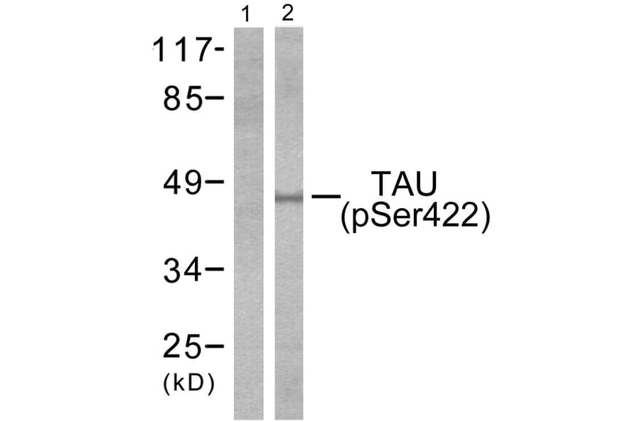 Western Blot - Anti-Tau (phospho Ser422) Antibody (A7243) - Antibodies.com