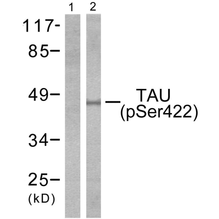 Western Blot - Anti-Tau (phospho Ser422) Antibody (A7243) - Antibodies.com