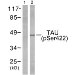 Western Blot - Anti-Tau (phospho Ser422) Antibody (A7243) - Antibodies.com