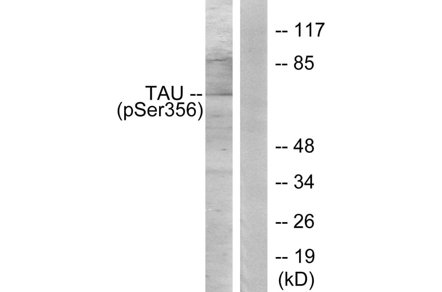 Western Blot - Anti-Tau (phospho Ser356) Antibody (A7240) - Antibodies.com