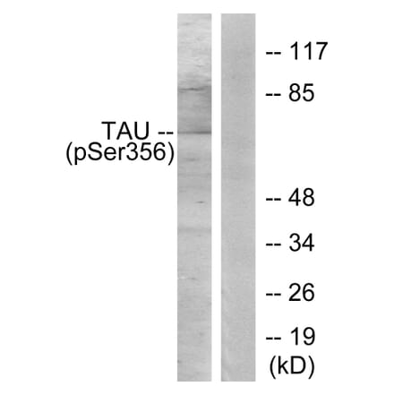 Western Blot - Anti-Tau (phospho Ser356) Antibody (A7240) - Antibodies.com
