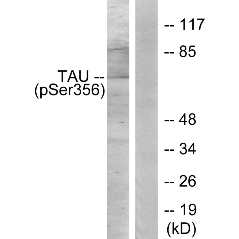 Western Blot - Anti-Tau (phospho Ser356) Antibody (A7240) - Antibodies.com