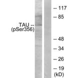 Western Blot - Anti-Tau (phospho Ser356) Antibody (A7240) - Antibodies.com