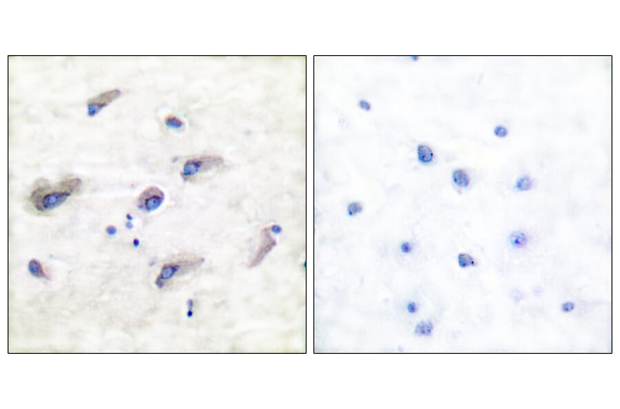 Immunohistochemistry - Anti-Tau (phospho Ser356) Antibody (A7240) - Antibodies.com