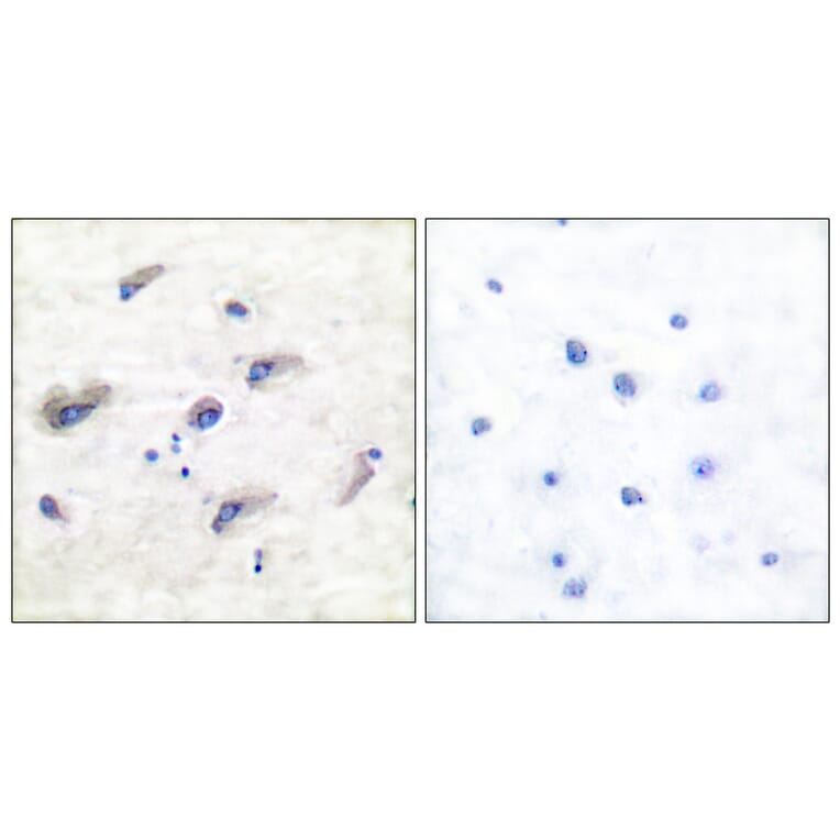 Immunohistochemistry - Anti-Tau (phospho Ser356) Antibody (A7240) - Antibodies.com