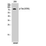 Western Blot - Anti-Tau (phospho Ser356) Antibody (A7240) - Antibodies.com