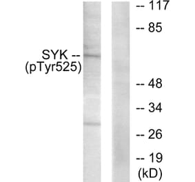 Western Blot - Anti-SYK (phospho Tyr525) Antibody (A0092) - Antibodies.com