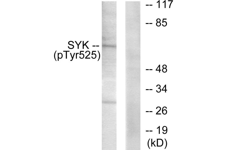 Western Blot - Anti-SYK (phospho Tyr525) Antibody (A0092) - Antibodies.com