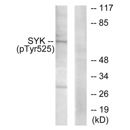 Western Blot - Anti-SYK (phospho Tyr525) Antibody (A0092) - Antibodies.com
