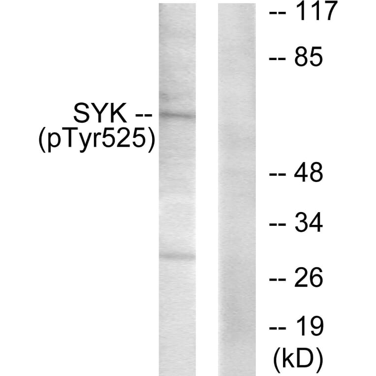 Western Blot - Anti-SYK (phospho Tyr525) Antibody (A0092) - Antibodies.com