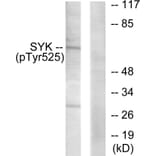 Western Blot - Anti-SYK (phospho Tyr525) Antibody (A0092) - Antibodies.com