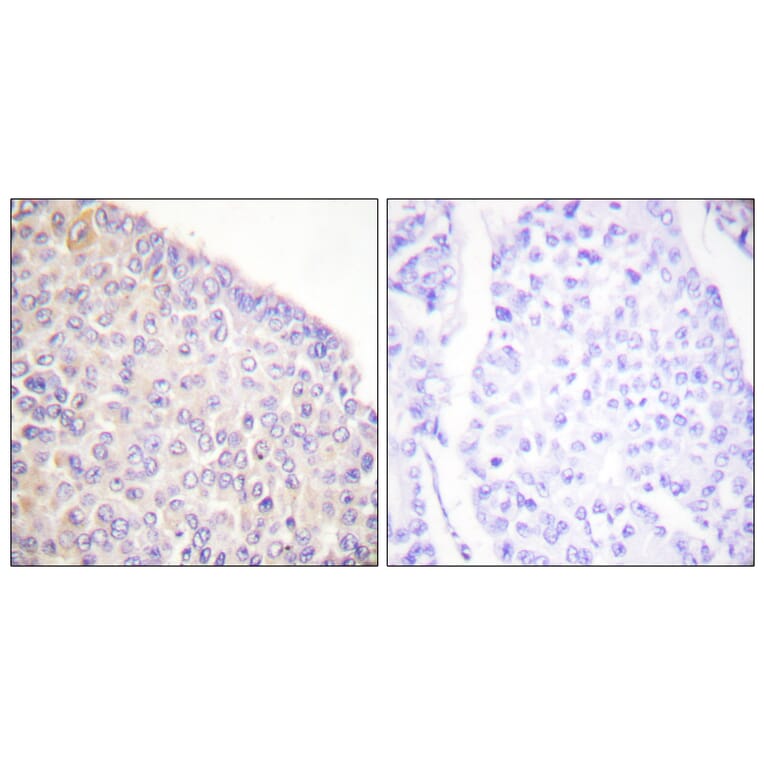 Immunohistochemistry - Anti-SYK (phospho Tyr525) Antibody (A0092) - Antibodies.com
