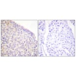 Immunohistochemistry - Anti-SYK (phospho Tyr525) Antibody (A0092) - Antibodies.com