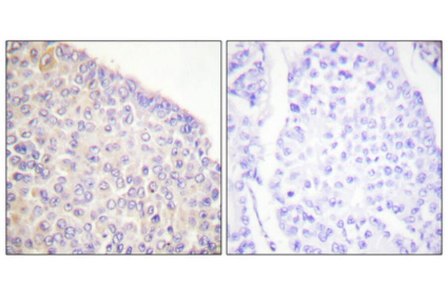 Immunohistochemistry - Anti-SYK (phospho Tyr525) Antibody (A0092) - Antibodies.com
