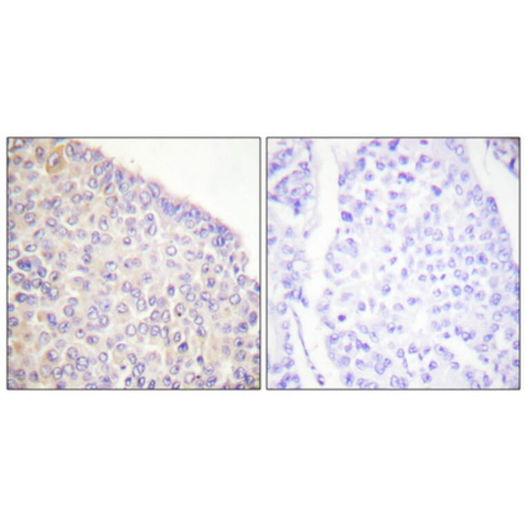Immunohistochemistry - Anti-SYK (phospho Tyr525) Antibody (A0092) - Antibodies.com