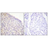 Immunohistochemistry - Anti-SYK (phospho Tyr525) Antibody (A0092) - Antibodies.com