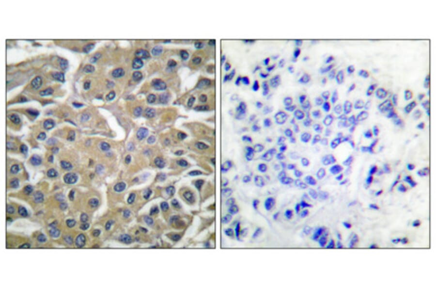 Immunohistochemistry - Anti-SYK (phospho Tyr525) Antibody (A0092) - Antibodies.com