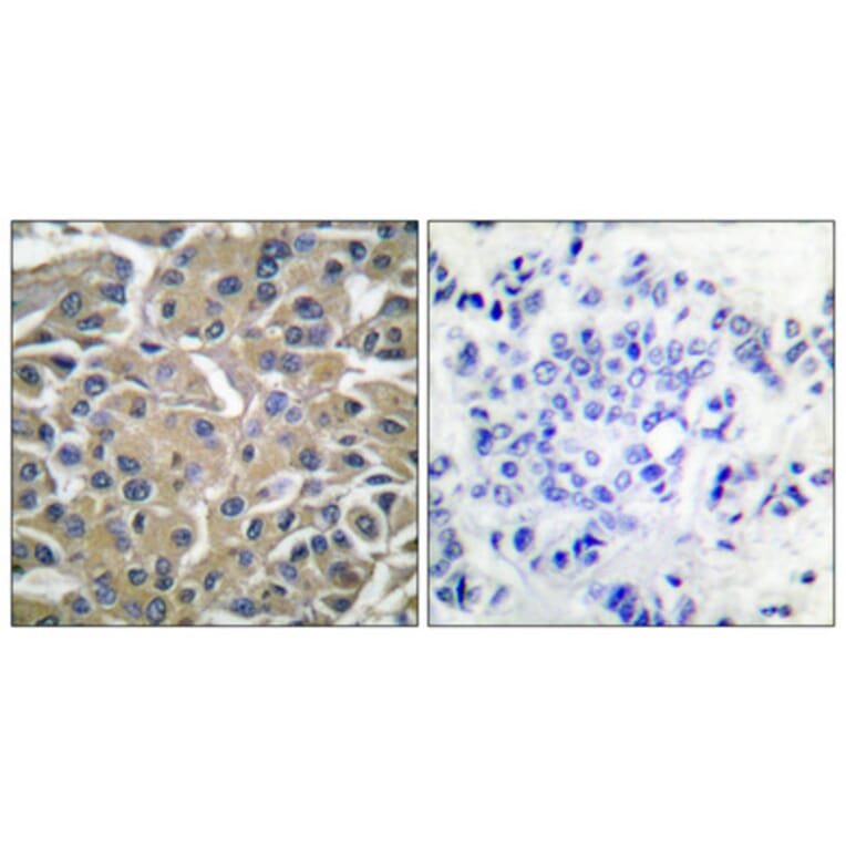 Immunohistochemistry - Anti-SYK (phospho Tyr525) Antibody (A0092) - Antibodies.com