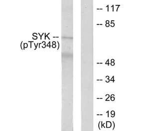 Western Blot - Anti-SYK (phospho Tyr348) Antibody (A0091) - Antibodies.com