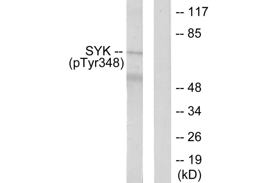 Western Blot - Anti-SYK (phospho Tyr348) Antibody (A0091) - Antibodies.com