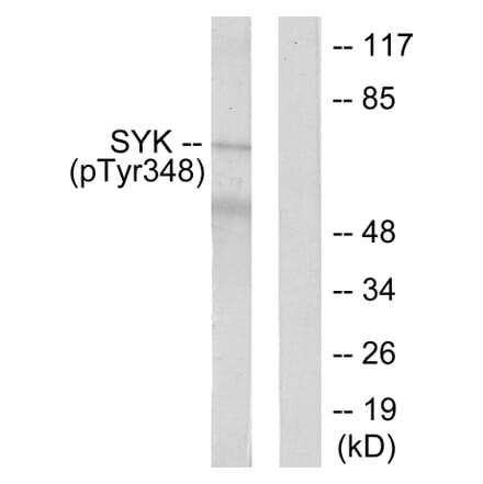 Western Blot - Anti-SYK (phospho Tyr348) Antibody (A0091) - Antibodies.com