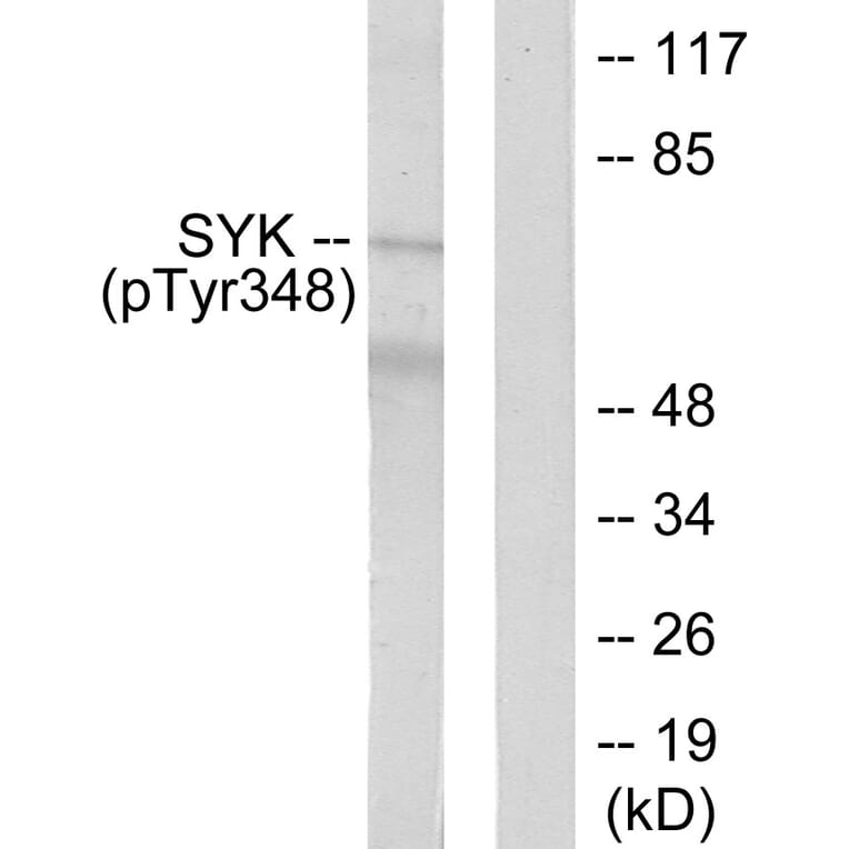 Western Blot - Anti-SYK (phospho Tyr348) Antibody (A0091) - Antibodies.com