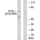 Western Blot - Anti-SYK (phospho Tyr348) Antibody (A0091) - Antibodies.com