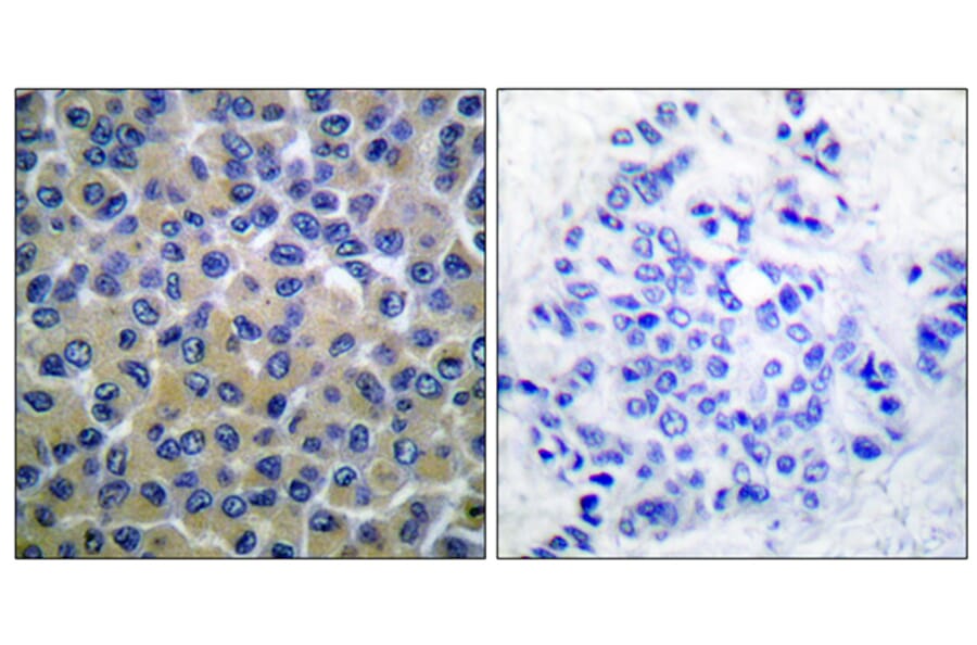 Immunohistochemistry - Anti-SYK (phospho Tyr348) Antibody (A0091) - Antibodies.com