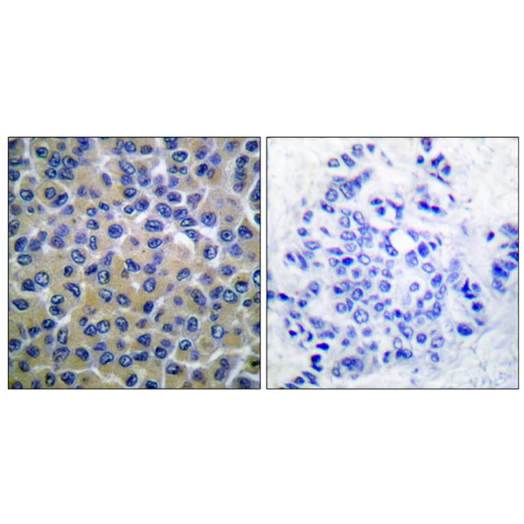 Immunohistochemistry - Anti-SYK (phospho Tyr348) Antibody (A0091) - Antibodies.com