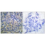 Immunohistochemistry - Anti-SYK (phospho Tyr348) Antibody (A0091) - Antibodies.com