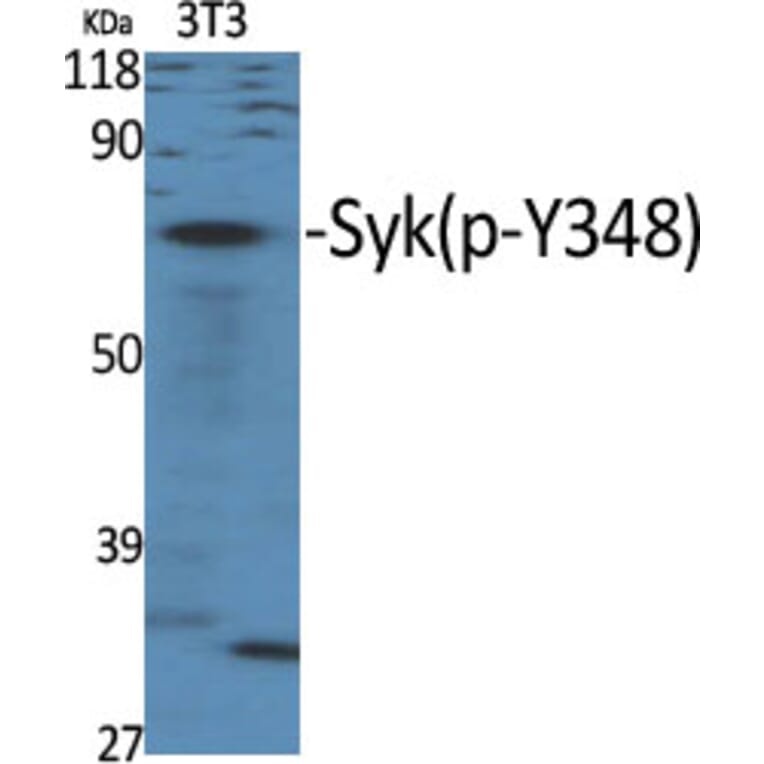 Western Blot - Anti-SYK (phospho Tyr348) Antibody (A0091) - Antibodies.com